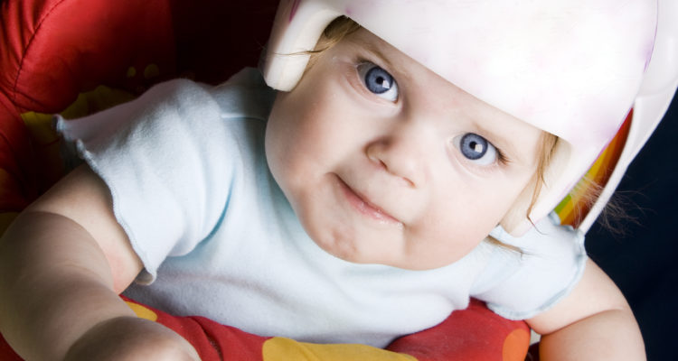 Craniofacial Anomalies & Syndromes